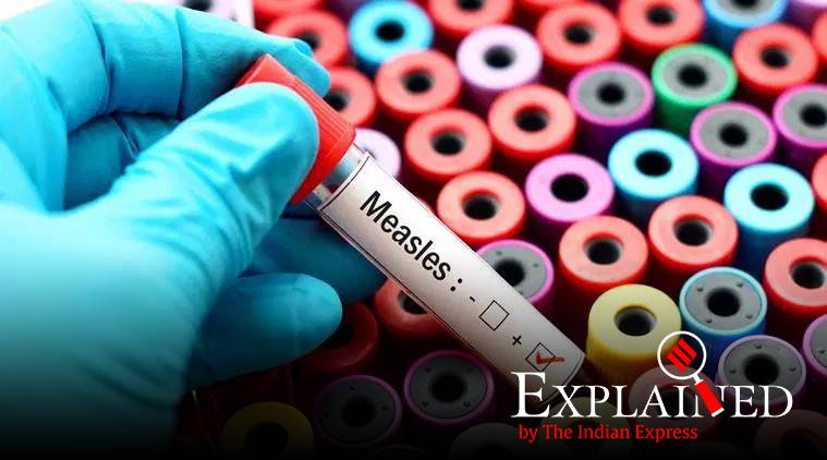 measles, measles rubella, measles Rubella virus, children at risk, health, india measles, india measles vaccine, India measles cases, sri lanka, sri lanka measles, world health organisation, Indian express