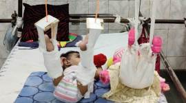 delhi hospitals. Lok Nayak Hospital, delhi, delhi news, latest news, 11 month baby fracture, indian express