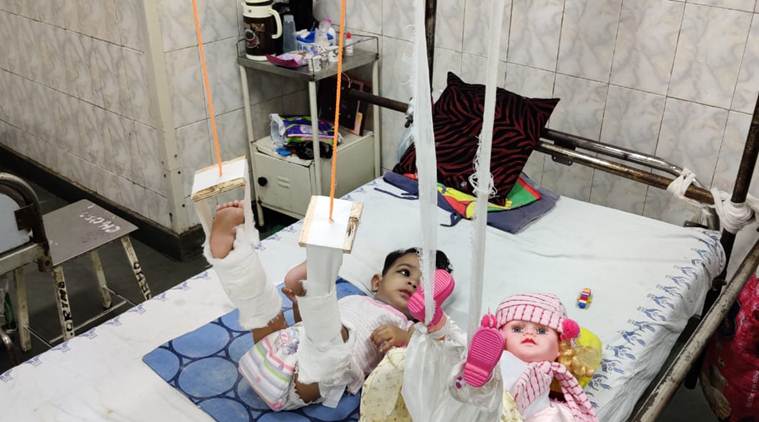 delhi hospitals. Lok Nayak Hospital, delhi, delhi news, latest news, 11 month baby fracture, indian express