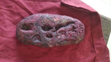 mp woman fakes pregnancy, woman fakes pregnancy, mp woman stillborn baby, madhya pradesh fake pregnancy, mp pregnant woman, mp woman carries dough, indian express