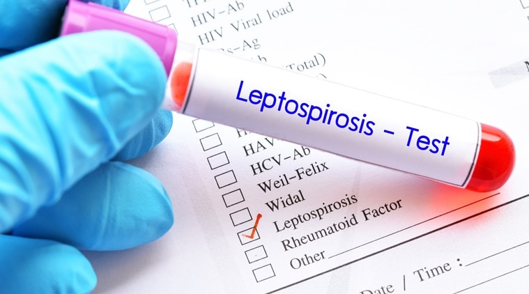 In Mumbai, ‘Six leptospirosis deaths’ since monsoon started, health