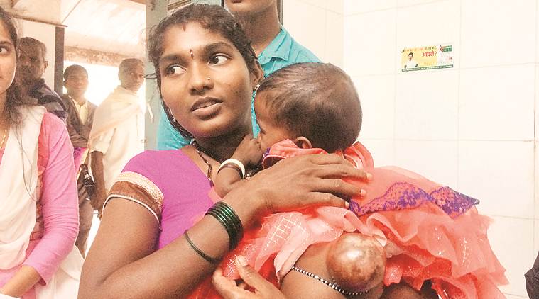 spina bifida, spina bifida disease, spina bifida patients in india, fssai, folic acid