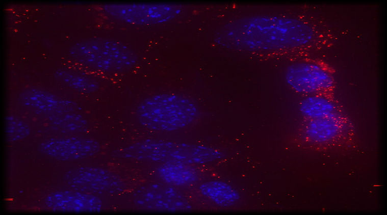 cancer curing tiny bubbles, cancer treating tiny bubbles, tiny bubbles that cure cancer better than chemotherapy, cancer treatment study by Michigan State University, cancer treatment study by Masamitsu Kanada