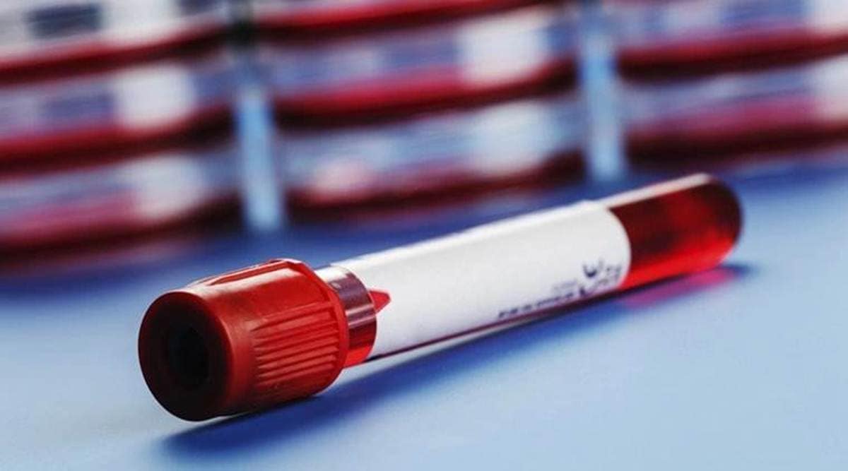 congo fever, congo fever in gujarat, gujarat congo fever cases, gujarat congo fever deaths, indian express news