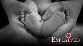 foetus in foetu, what is foetus in foetu, birth of twin, twin formation, express explained, indian express