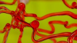 Massachusetts Institute of Technology, MIT, MIT scientists create robotic thread, wormlike robotic thread, robotic worm inside brain, magnetic thread inside brain, robotic worm to cure blood clot
