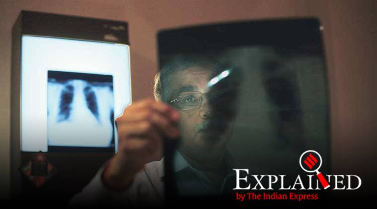 Rise in notified TB cases: breakup by state, age, gender