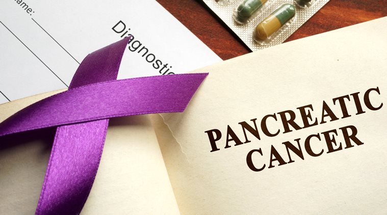 Pancreatic cancer, colorectal cancer, diabates, obesity, smoking, indianexpress.com, indianexpress, new study, global death rates of cancer, blood glucose levels, UEG Week 2019 Barcelona, colorectal cancer screening programmes