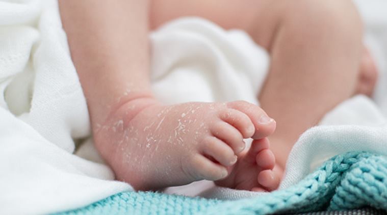 arkiv Grader celsius Føde How to manage your baby's dry skin | Parenting News,The Indian Express
