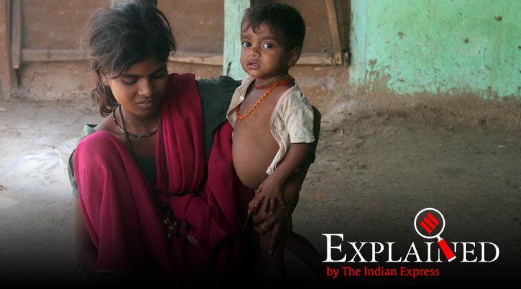 Half of India’s children suffer from malnutrition: UNICEF