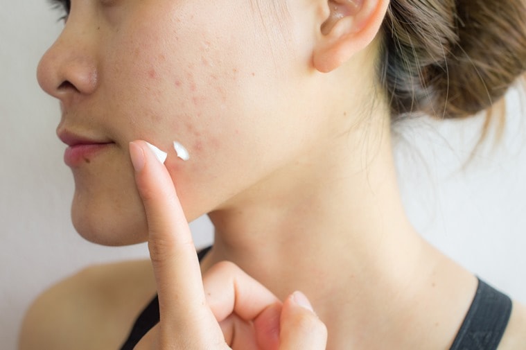 Bakuchiol, Bakuchiol benefits, what is Bakuchiol?, Bakuchiol or retinol, Bakuchiol retinol alternative, skincare, skincare benefits, lifestyle, indian express