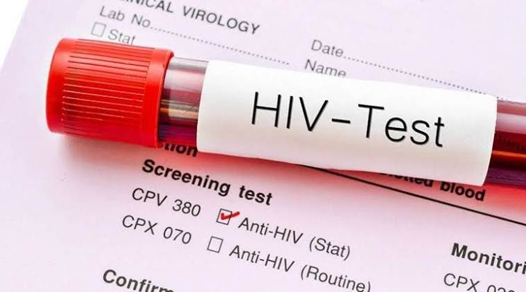 First time in two decades, new HIV subtype found by genetic sequencing ...