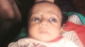 Mumbai baby suffers burns in ICU, KEM hospital Mumbai, KEM hospital Mumbai accident, Mumbai news, indian express