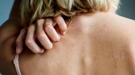 itchy skin, scratching, indian express news