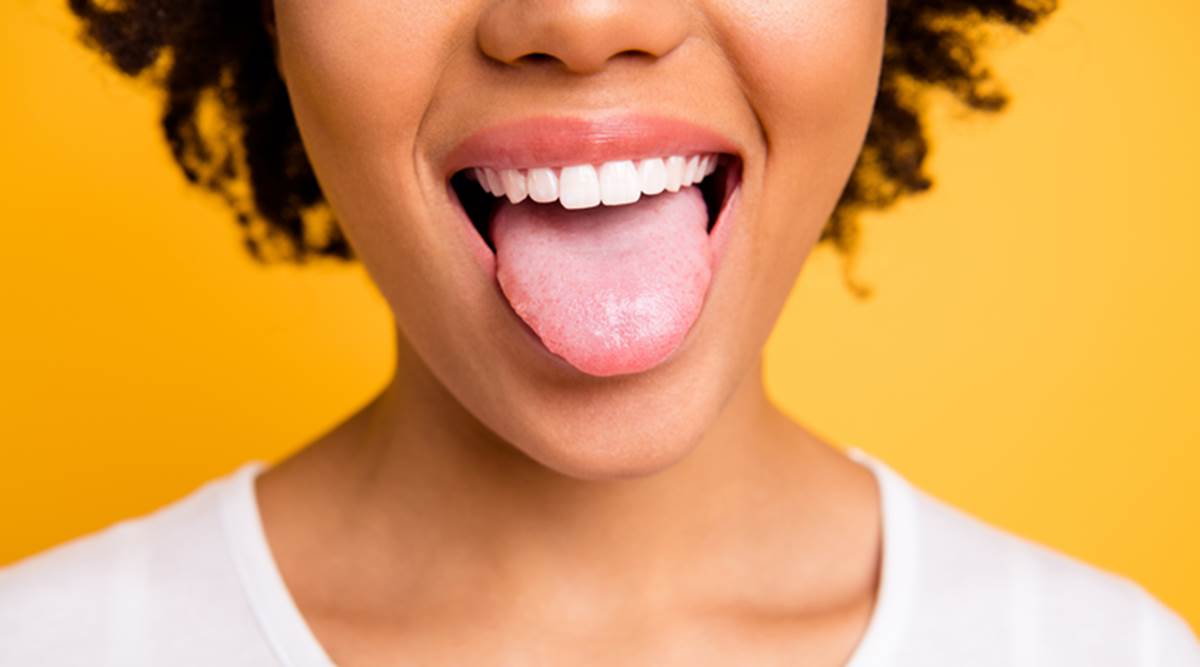 Can you tell if you have a healthy tongue? | Lifestyle News,The ...
