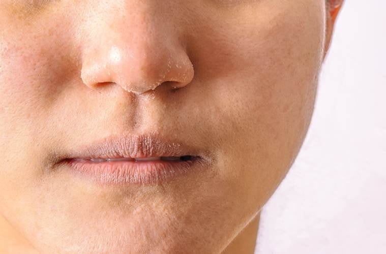 winters, aging in winters, winter care, health, skin, indian express, indian express news