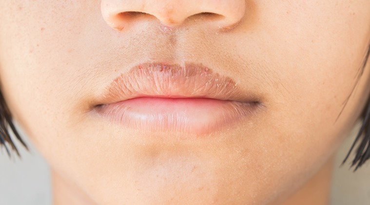 https://images.indianexpress.com/2019/12/chapped-lips.jpg?w=1200