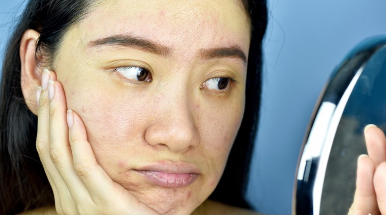 How can dry and dull skin be prevented