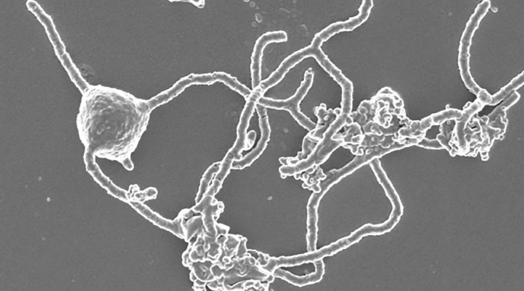 This strange microbe may mark one of life’s great leaps