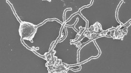 microbe, Microbes, This strange microbe may mark one of life’s great leaps