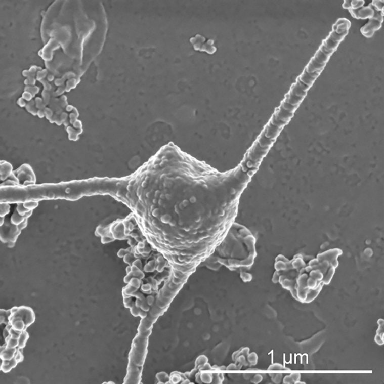 microbe, Microbes, This strange microbe may mark one of life’s great leaps