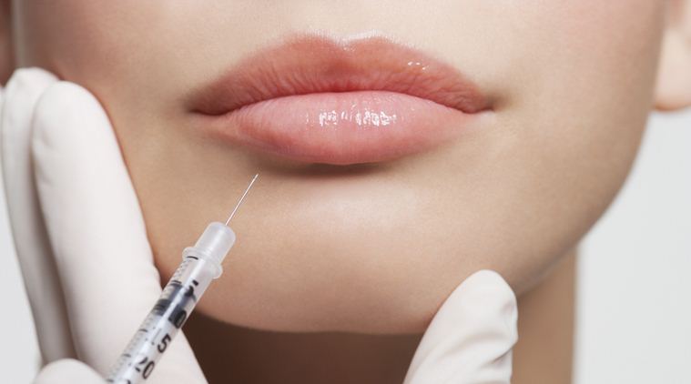 Things you must know before getting your lips done | Lifestyle News,The  Indian Express