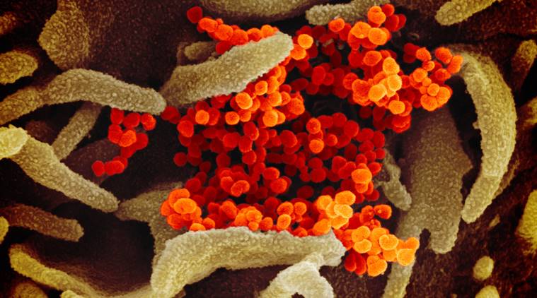 Coronavirus pictures, Coronavirus photos microscope, what Coronavirus looks like, coronavirust COVID-19 photos, Coronavirus COVID 19