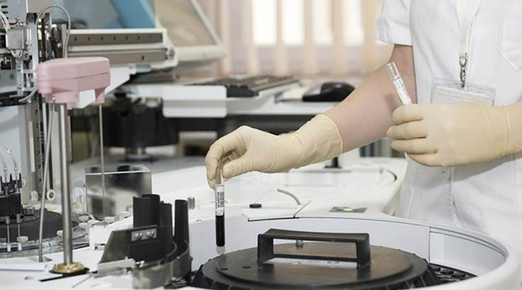 Coronavirus outbreak, Private labs, Coronavirus tests, Mumbai news, indian express news