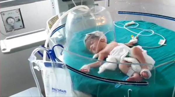 ahmedabad new born baby, ahmedabad new born abandoned, ahmedabad new born baby bitten by dogs, ahmedabad news, indain express