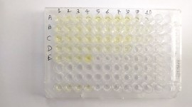 novel coronavirus, SARS-COV-2, COVID-19 testing, coronavirus outbreak, economy news, indian express news