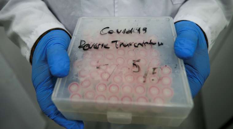 An Expert Explains: 'Coronavirus tests needed, but each country has priorities'