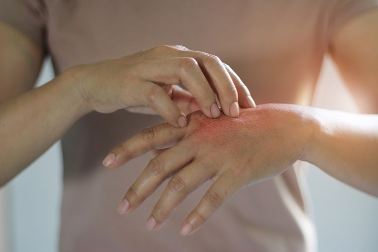 Tips to protect hands from washing dishes