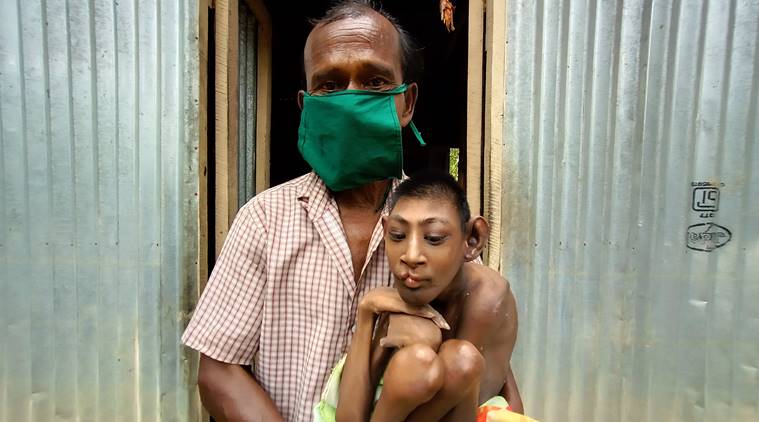 india lockdown, Tripura lockdown, Agartala slums, Tripura slums, Tripura govt, coronavirus lockodnw, slums in lockdown, disabled pension, covid-19 india, coronavirus news, latest news