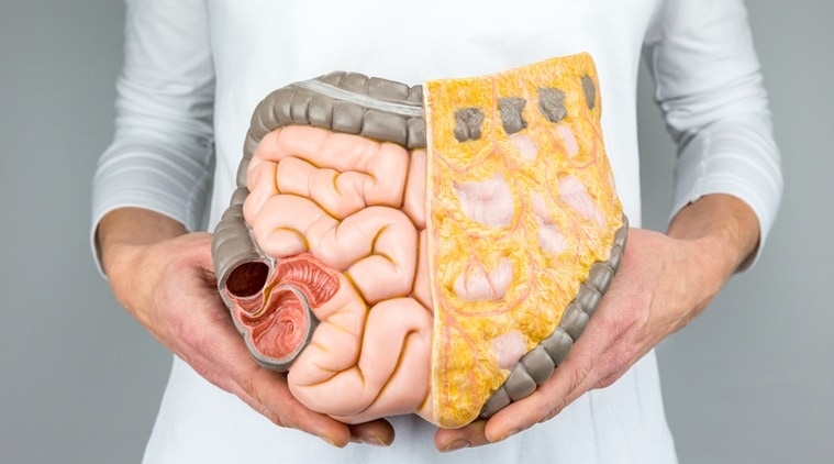 Colon Infection Everything You Need To Know About It Lifestyle News The Indian Express