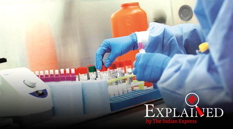 Coronavirus, coronavirus test, how to test coronavirus, coronavirus test kerala, kerala coronavirus cases, new test coronavirus kerala, kerala covid 19 test, express explained coronavirus