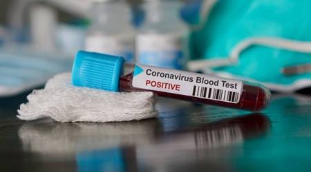 coronavirus, coronavirus outbreak, coronavirus cases in delhi, crpf men test positive in delhi, crpf jawan test positive, coronavirus news, indian express