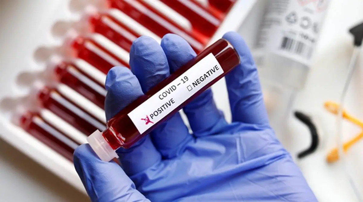 Coronavirus test, covid 19 cases, Screening patient, Gujarat government, indian express news