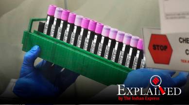 Explained: How dead coronavirus particles could be affecting the outcome of test results