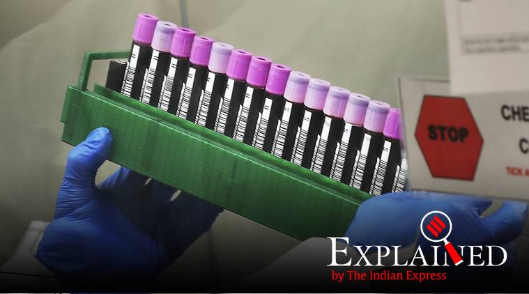 Explained: How dead coronavirus particles could be affecting the outcome of test results