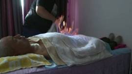 fire therapy, chinese medical therapy