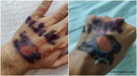 goa stamps, quarantine stamps, coronavirus stamps, goa news, india lockdown, quarantine covid 19 news, latest news, indian express