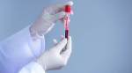 Covid-19 testing capacity mostly dependent on foreign firms