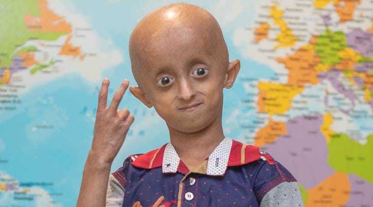 Children with progeria hold out messages of hope in lockdown ...