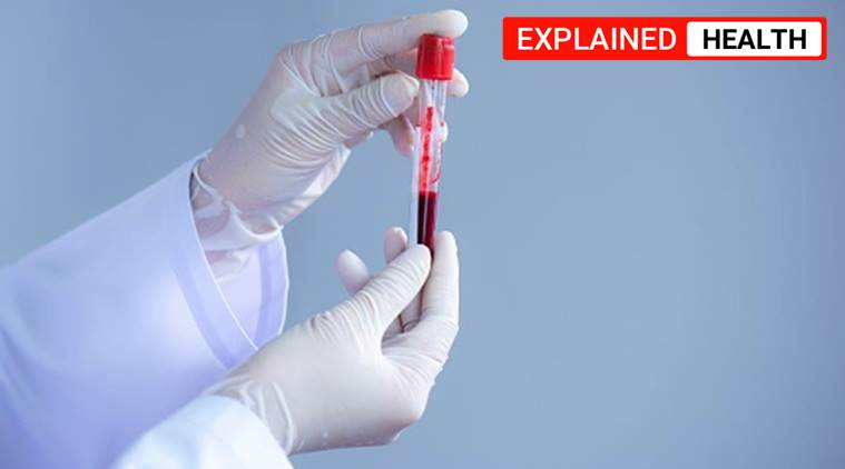 express explained, delhi coronavirus, delhi coronavirus latest updates, delhi plasma banks, delhi plasma donors, Institute of Liver and Biliary Sciences, arvind kejriwal, delhi news, indian express