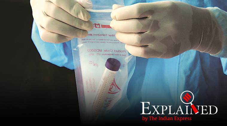 coronavirus test, covid-19 test, coronavirus india, covid-19 india explained, covid-19 test, ELISA coronavirus tests, coronavirus tests india, RT-PCR tests,