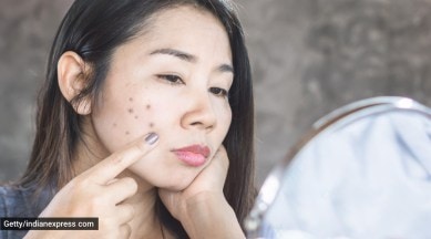 chlorophyll , chlorophyll trend acne tiktok, drinking chlorophyll benefits, chlorophyll trend beauty tiktok instagram, indian express news