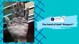 Coronavirus, COVID-19, Doctors hand, Wrinkle hands, Frontline workers, Trending news, Indian Express news