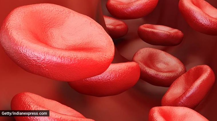sickle cell disease, anaemia, indianexpress