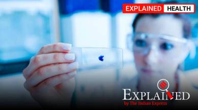 Cancer, Cancer detection through blood test, Cancer tests, how cancer is diagnosed, Taizhou Longitudinal Study, Express explained, explained health