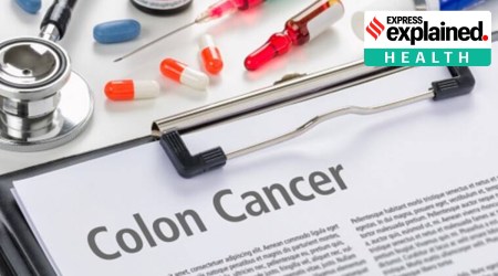 What is Colon cancer, Colon cancer symptoms, Colon cancer causes, colon cancer treatment, indian express explained